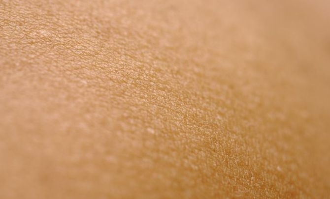 Skin-Concerns