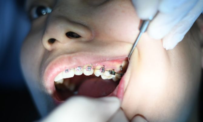 Managing Dental Anxiety